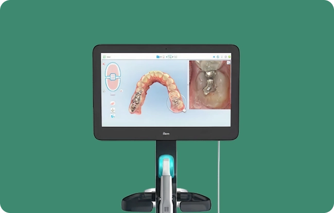 Dental monitoring equipment